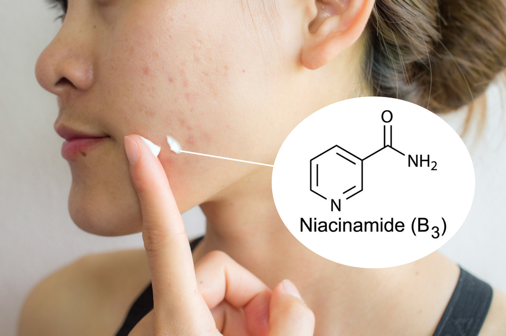 Niacinamide vừa hạn chế tình trạng tiết dầu nhờn, vừa giúp giảm thâm mụn
