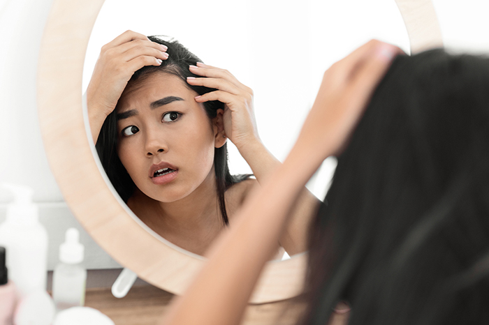 Người bị stress, lo âu trong thời gian dài dễ bị rụng tóc