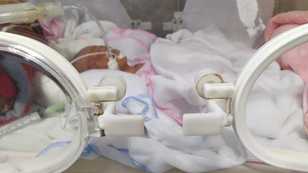 Lúc chào đời em bé chỉ nặng 900gr đến khi ra viện là 2,6kg - Ảnh: VTV.vn