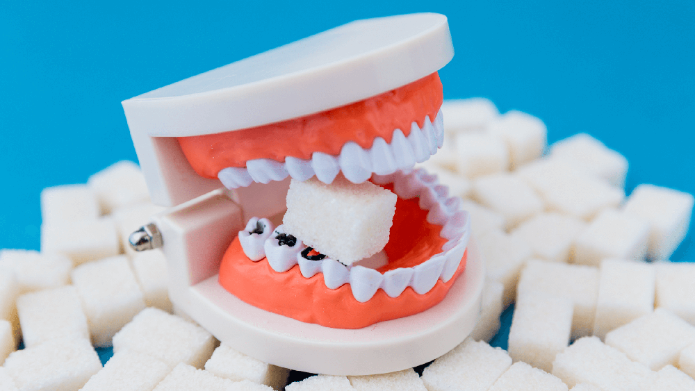 Thường xuyên dùng đồ ngọt mà không vệ sinh răng miệng đúng cách làm tăng nguy cơ sâu răng 