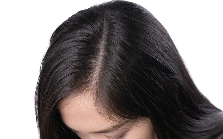 Gội đầu 2 lần liên tiếp giúp làm sạch sâu da đầu, loại bỏ gàu và dầu nhờn bám trên tóc
