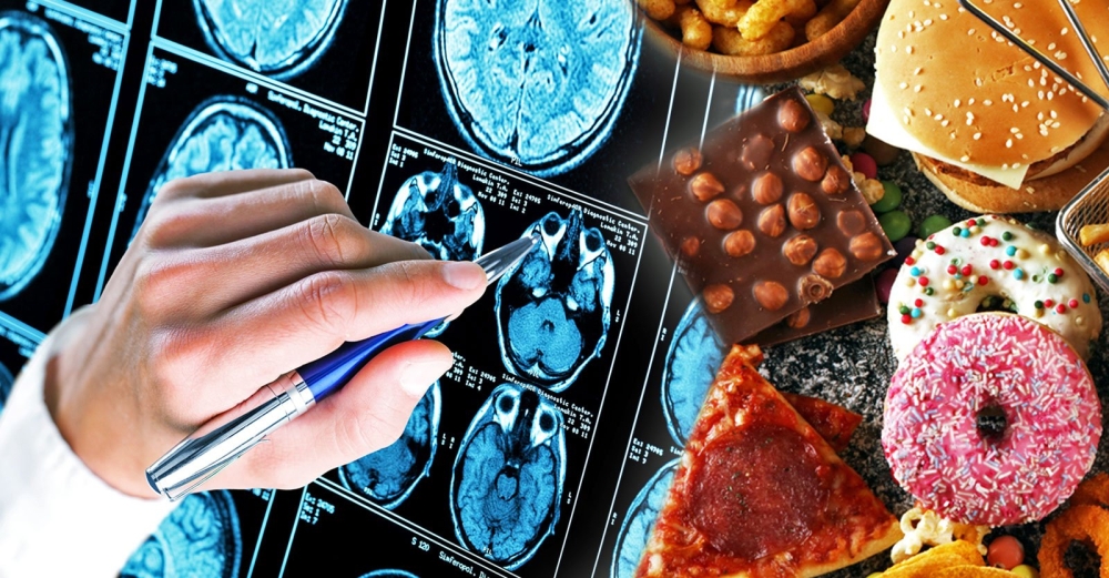 Các nghiên cứu tìm thấy mối liên hệ giữa thực phẩm chế biến sẵn và bệnh Alzheimer