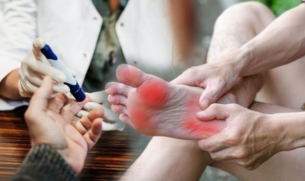 Người bệnh đái tháo đường dễ bị loét bàn chân nếu không kiểm soát đường huyết tốt