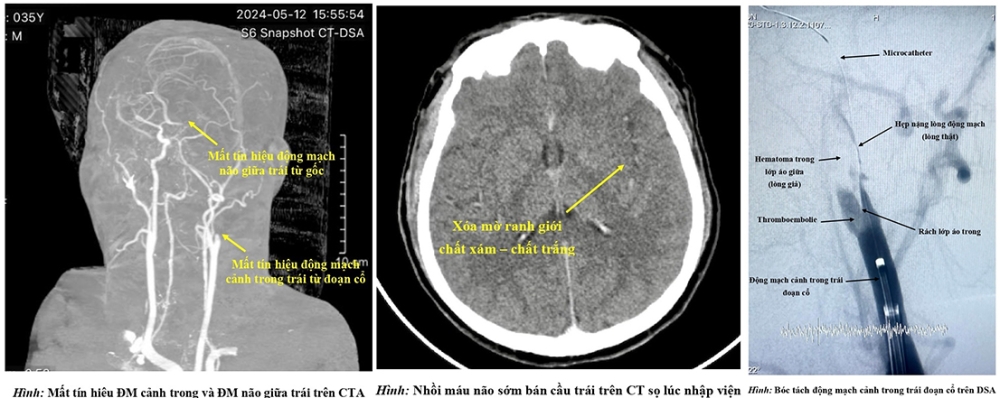Hình ảnh chụp CT của bệnh nhân S. - Ảnh: BVCC