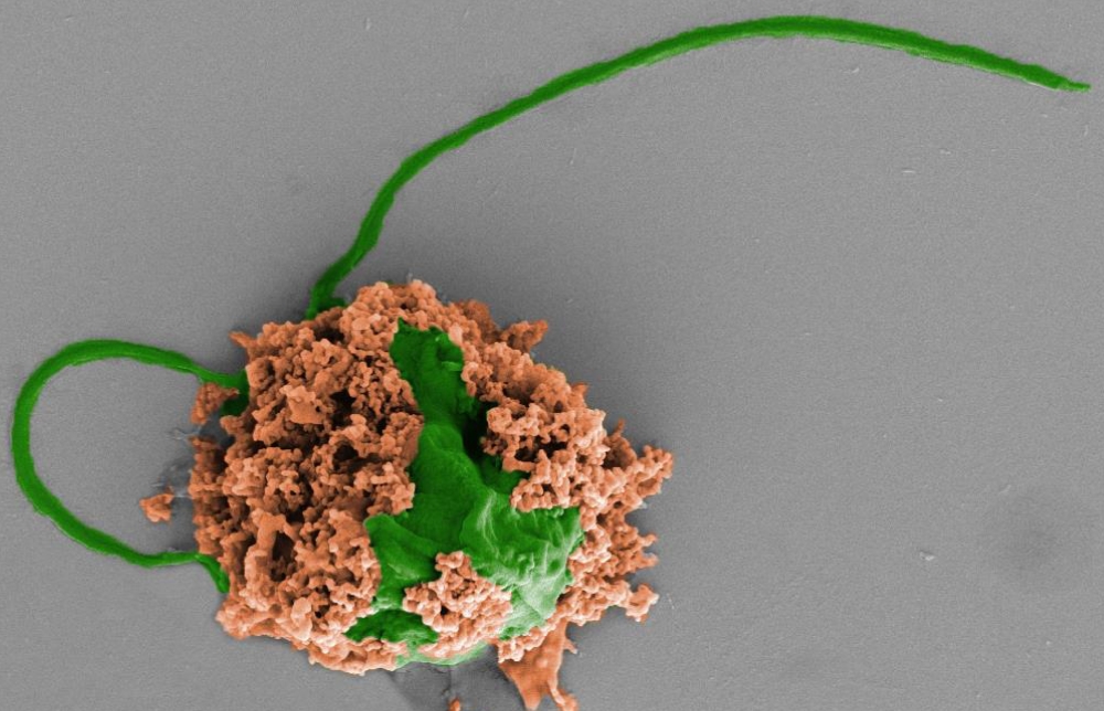Hình ảnh phóng đại một robot siêu nhỏ với một phần là tảo (màu xanh lá cây) được bao phủ bởi các hạt nano chứa đầy thuốc (màu cam) và màng tế bào hồng cầu - Ảnh: UCSD