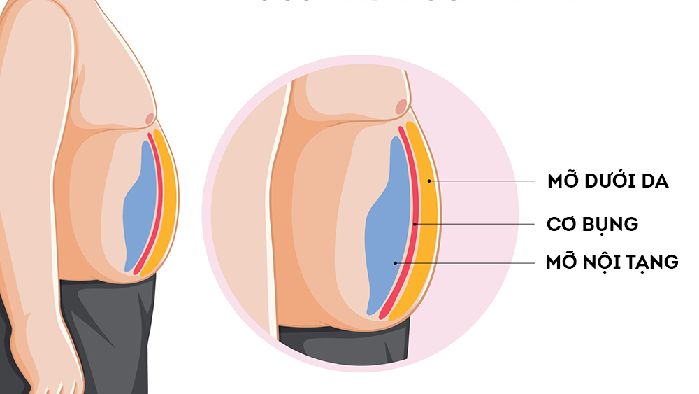 Tập thể dục giúp cải thiện cấu trúc mỡ dưới da, giảm nguy cơ hình thành mỡ xấu là mỡ nội tạng