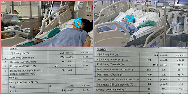 2 trong 3 trường hợp bệnh nhân suy thận phải nhập viện cấp cứu do tin dùng nước ion kiềm để chữa bệnh - Ảnh: BS Ngô Đức Hùng