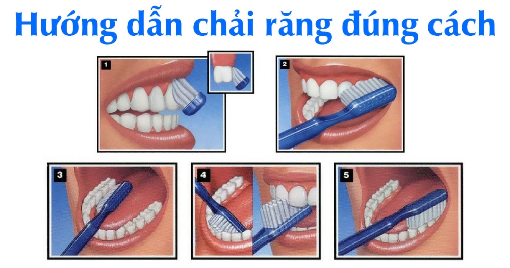 Ảnh: Nha khoa và Đời sống.