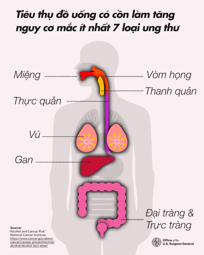 Việc tiêu thụ rượu bia làm tăng nguy cơ mắc ít nhất 7 loại ung thư, bao gồm ung thư vú, đại tràng và gan,... - Nguồn: The U.S. Surgeon General’s Advisory.