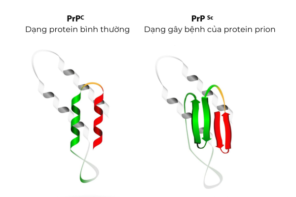 Ảnh minh hoạ khi protein prion bị biến đổi gây bệnh 