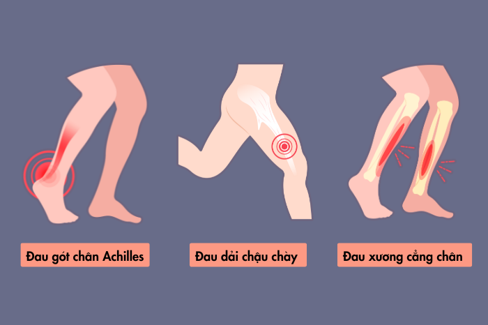 Khi mắc phải chấn thương, người tập cần dừng ngay mọi hoạt động để chân có thời gian nghỉ ngơi.