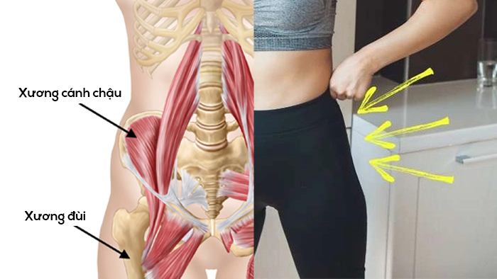 Hõm hông là do cấu trúc xương bẩm sinh, không phải khuyến điểm hay vấn đề cân nặng