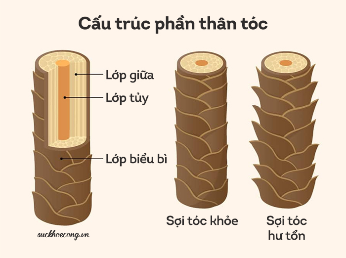 soi-toc