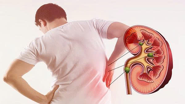 Cần chủ động theo dõi, kiểm tra sức khỏe thận định kỳ