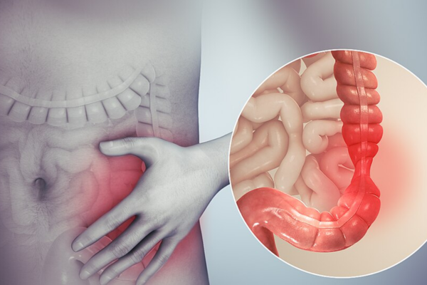 Một số triệu chứng của IBS có thể kể đến như: rối loạn đại tiện, đau bụng, đầy hơi chướng bụng,...