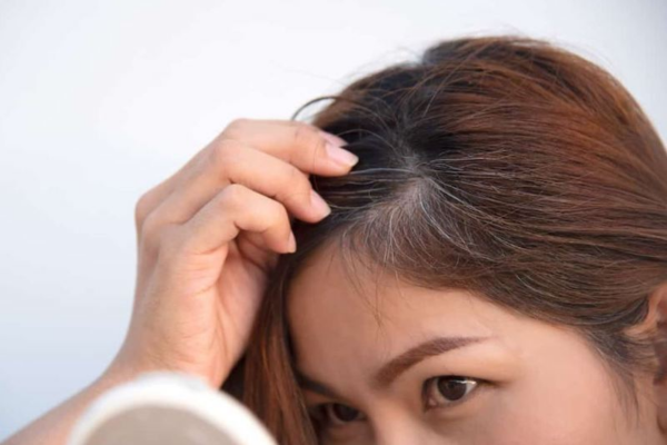 Tóc bạc sớm thường do yếu tố di truyền