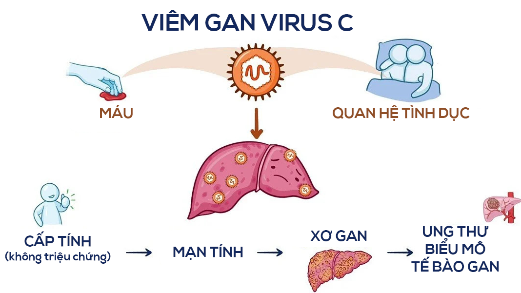 Virus viêm gan C có thể lây từ người này sang người khác qua đường máu, đường tình dục và từ mẹ sang con