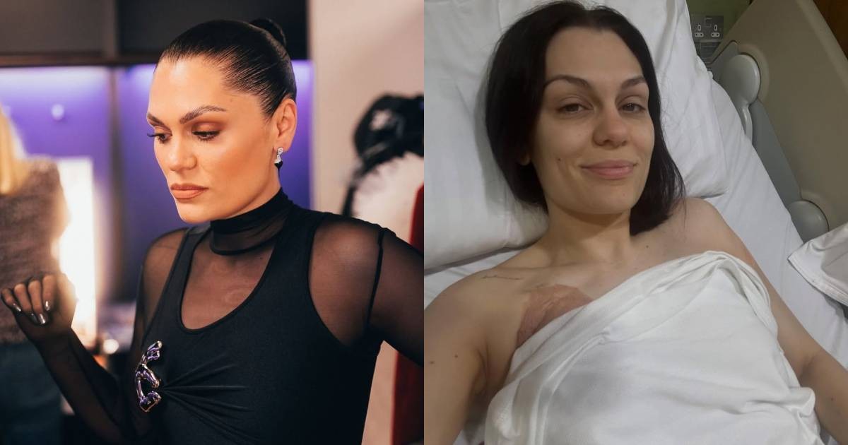 Nữ ca sĩ Jessie J chia sẻ trải nghiệm phẫu thuật điều trị ung thư vú trên trang cá nhân
