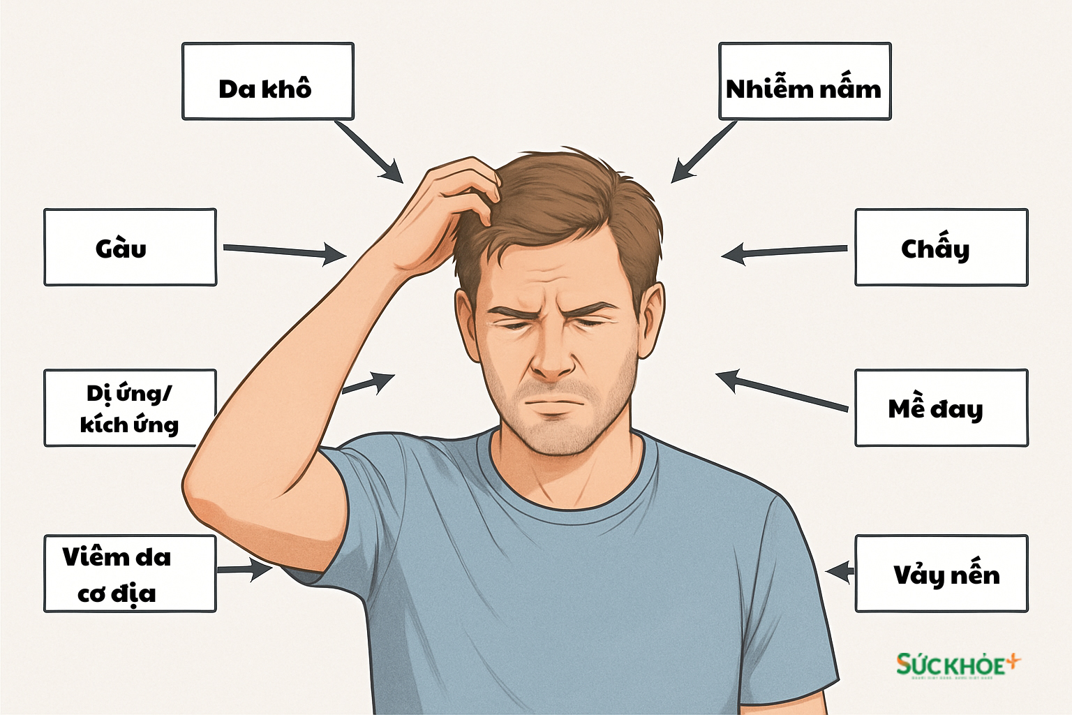 Một số nguyên nhân gây ngứa da đầu