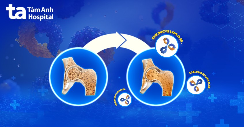 Denosumab tác động vào cơ chế bệnh sinh- Ảnh: Bệnh viện Đa khoa Tâm Anh