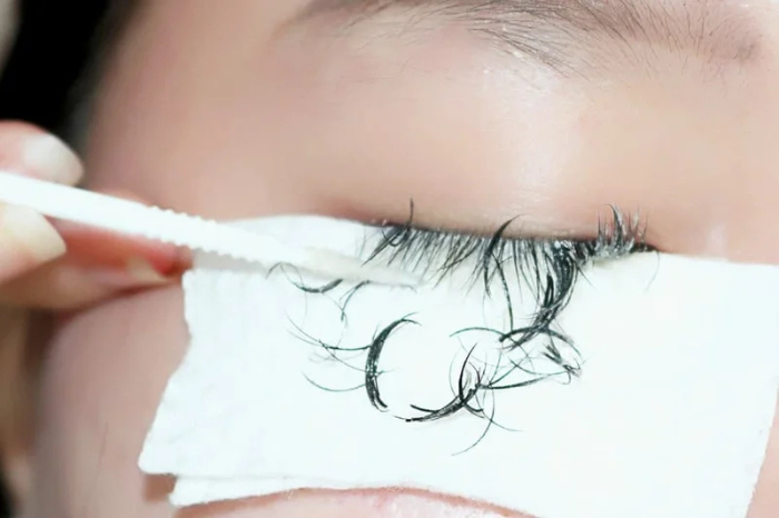 Một số người sau khi nối mi bị rụng mi thật nguyên nhân có thể do dị ứng với keo nối mi.