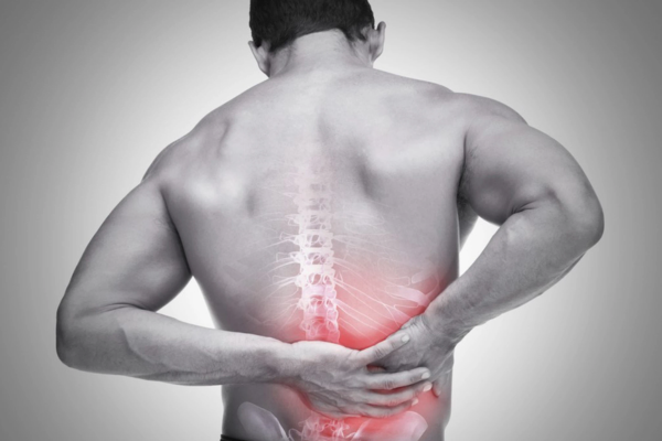 Gãy xương nén tạo cảm giác đau dữ dội vùng thắt lưng