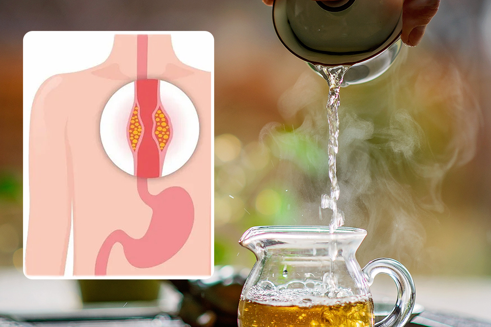 Nhiệt độ đồ uống quá cao làm tổn thương thực quản, tăng nguy cơ ung thư