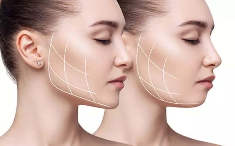 Nhai kẹo cao su không tác động nhiều đến xương hàm, nên không thể thu gọn gương mặt