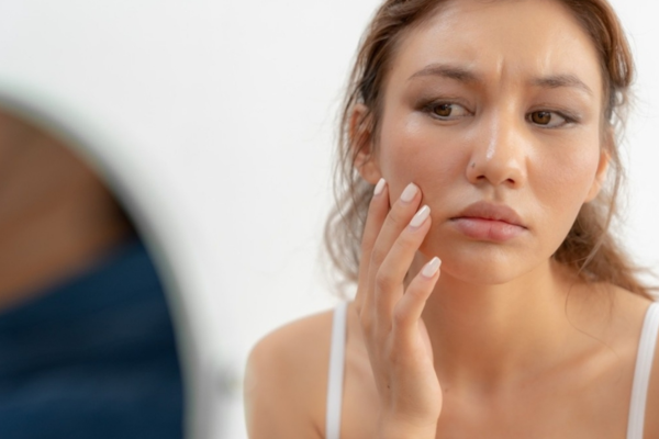 Da xỉn màu, kém sức sống, thiếu độ đàn hồi có thể do mất nước