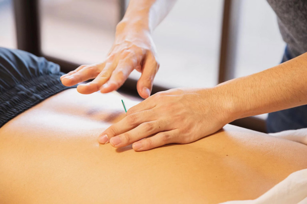 Bên cạnh công dụng giúp giảm đau lưng mạn tính, châm cứu còn giúp giảm đau đầu, đau khớp,...