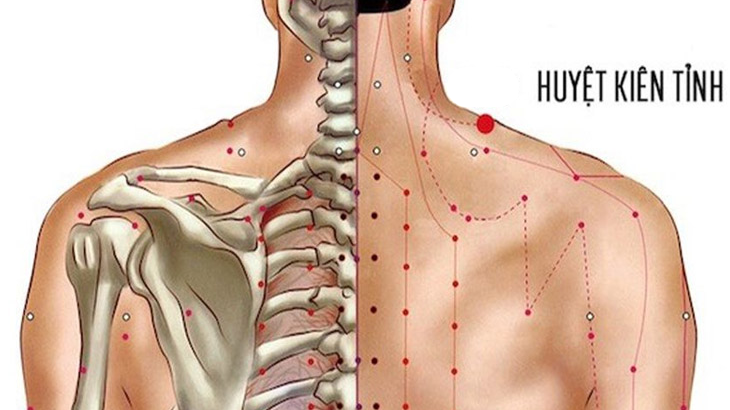 Vị trí huyệt Kiên Tỉnh hỗ trợ giảm đau mỏi vai gáy