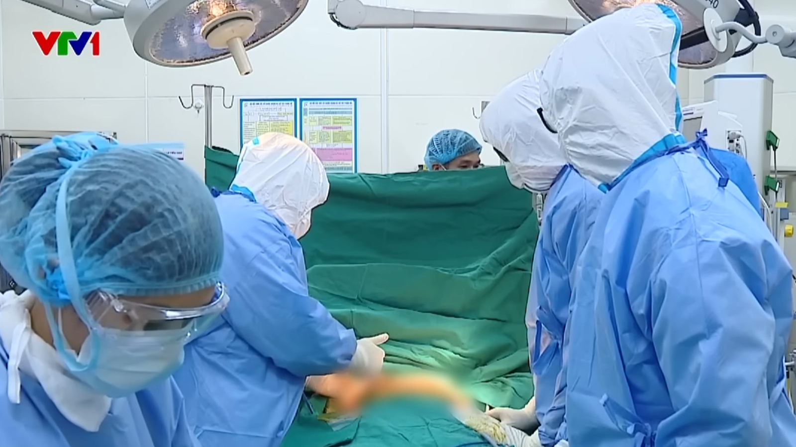 Ca phẫu thuật được ekip thực hiện trong khi sử dụng đồ bảo hộ cá nhân đầy đủ, áp dụng quy trình vô khuẩn nghiêm ngặt trong phòng mổ