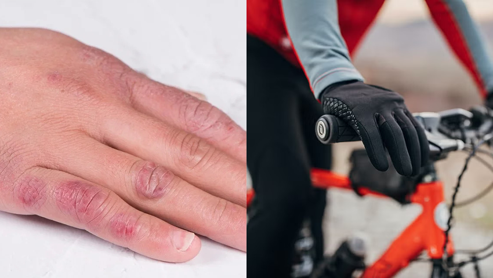 Đeo găng tay chuyên dụng để hạn chế cước khi đạp xe trong thời tiết lạnh