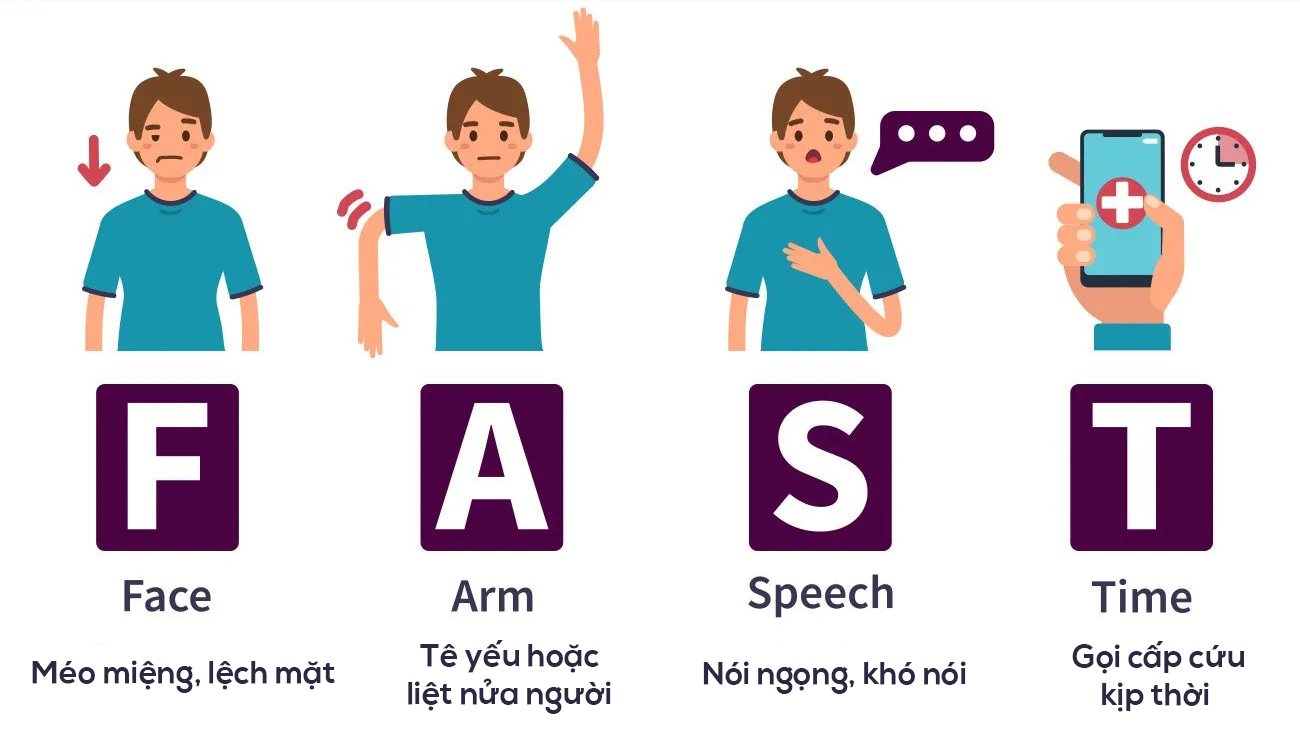 Nhận biết sớm các dấu hiệu tai biến mạch máu não như méo miệng, nói ngọng, yếu liệt tay chân để cấp cứu kịp thời trong “giờ vàng”