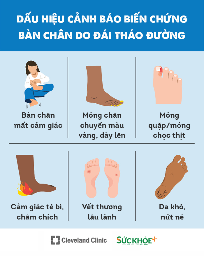 HTD-Bien chung ban chan