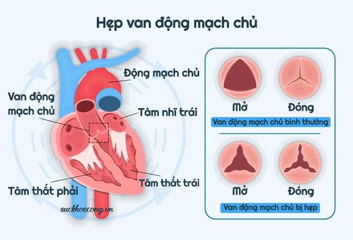 ITK-Hep van dong mach chu