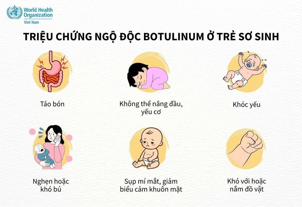 Những triệu chứng ngộ độc botulinum ở trẻ sơ sinh - Ảnh: WHO