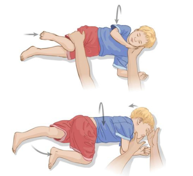 Nên đặt trẻ nằm nghiêng, đầu quay sang một bên để giữ thông thoáng đường thở