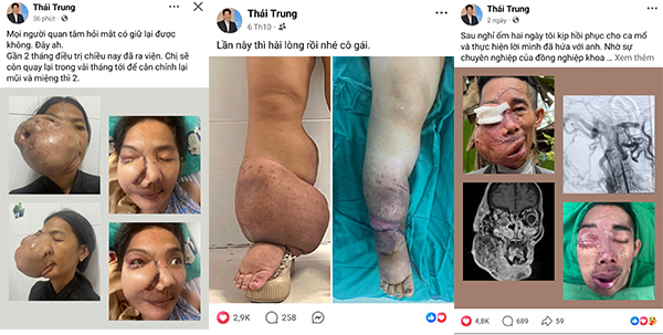 Những ca mổ khó được bác sĩ Trung chia sẻ trên trang cá nhân sau khi thực hiện thành công - Ảnh: FB 