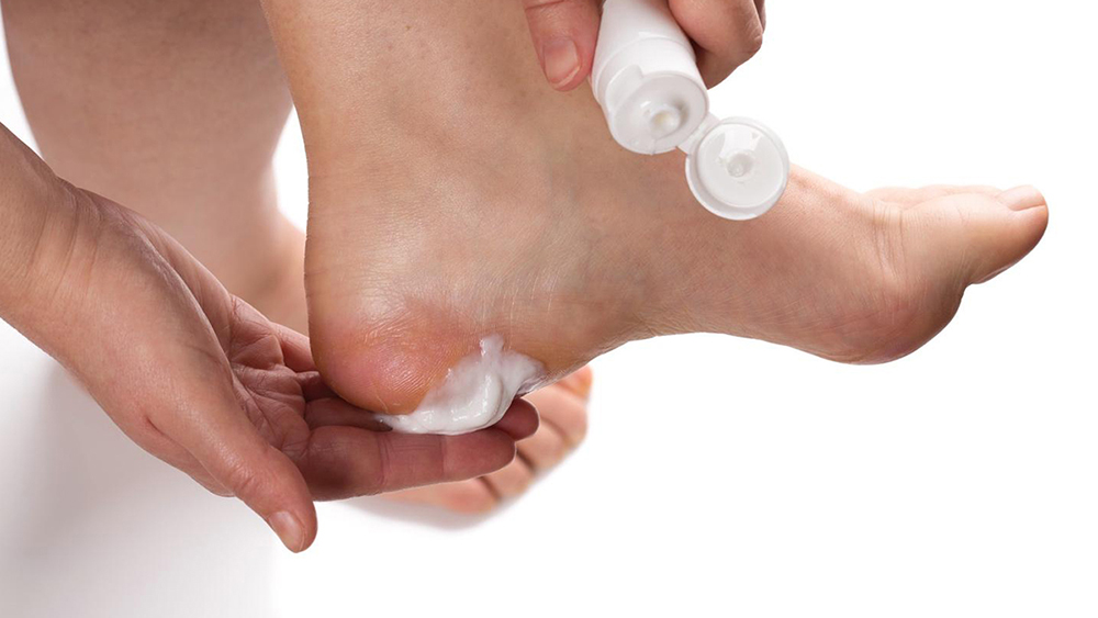 Trước khi đi ngủ, nên dưỡng ẩm gót chân bằng kem đặc giúp hạn chế nứt gót chân 