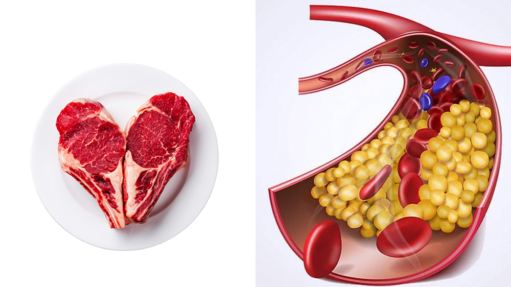 Ăn nhiều thịt và chất béo bão hòa có thể làm tăng cholesterol xấu, ảnh hưởng sức khỏe tim mạch về lâu dài