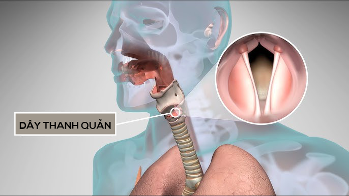 Khi bị cúm, dây thanh quản sưng phù và rung kém, khiến giọng nói yếu, khàn hoặc thậm chí mất tiếng tạm thời