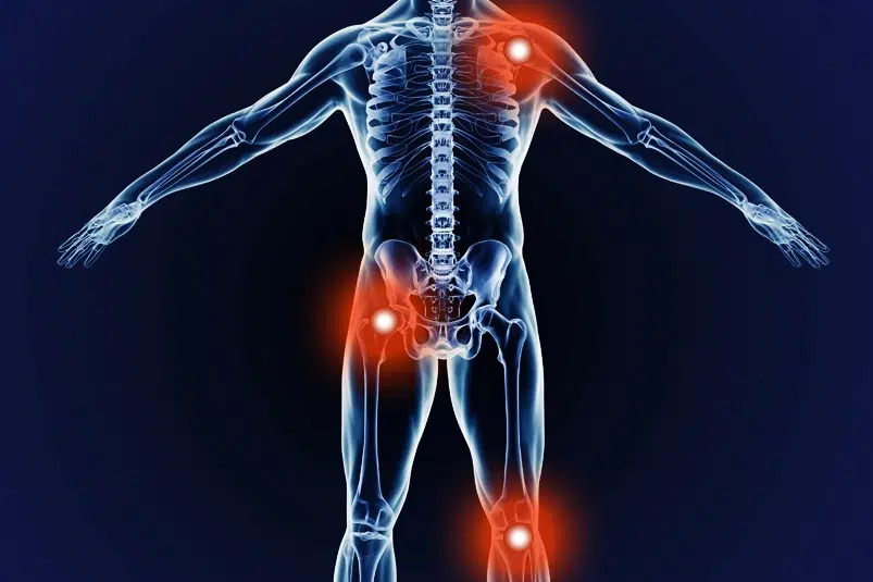 Khớp gối, khớp háng, khớp vai là những vị trí dễ bị đau và viêm do chịu tải lớn