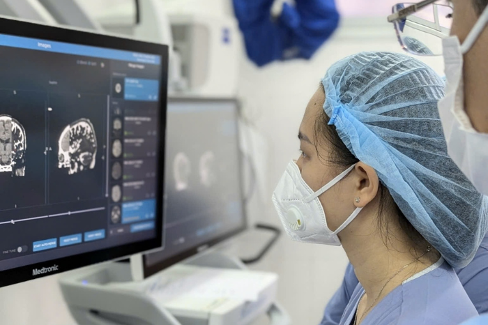 Ca phẫu thuật kích thích não sâu được thực hiện với sự phối hợp đồng bộ giữa các bác sĩ ngoại thần kinh và nội thần kinh. - Ảnh: BVCC.