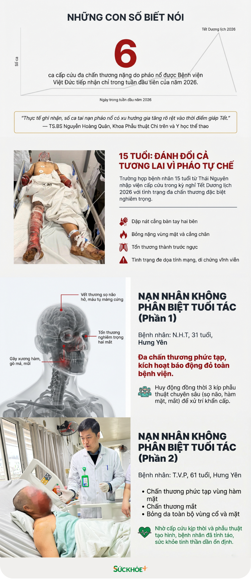 Bệnh viện Hữu nghị Việt Đức liên tục tiếp nhận nhiều ca cấp cứu do tai nạn pháo nổ, cho thấy nguy cơ loại tai nạn đặc biệt nguy hiểm này đang có dấu hiệu gia tăng trở lại.