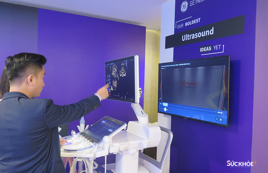 Máy siêu âm Voluson Expert 22 với hệ thống AI thế hệ mới được trưng bày trực quan - Ảnh: Đào Dung