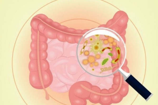 Nguyên nhân được xác định do một số loại vi khuẩn gây ra như E.coli và Klebsiella