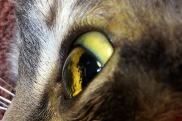 Khi sắc tố bilirubin của mật không được đào thải, tình trạng vàng da sẽ xuất hiện.