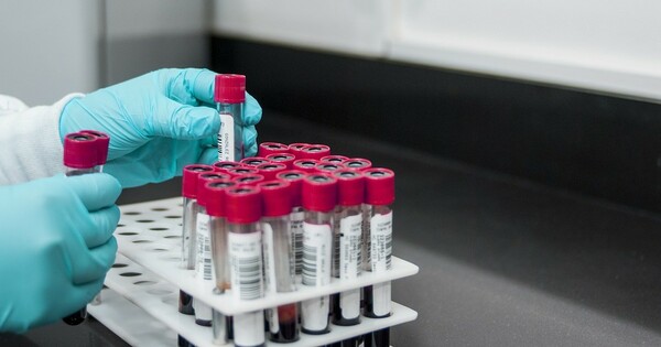 nghiên cứu mở ra triển vọng phát triển xét nghiệm máu nhằm phát hiện sớm bệnh nhân thận mạn tính có nguy cơ cao gặp biến chứng tim mạch