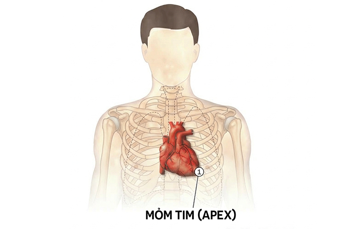 Nằm nghiêng trái khiến tim đập to (cảm giác đập mạnh) chủ yếu do tư thế này đưa mỏm tim sát gần thành ngực hơn